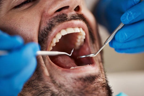 Best Emergency Cosmetic Dentistry (e.g., broken veneers) in Pocono Ranch Lands, PA